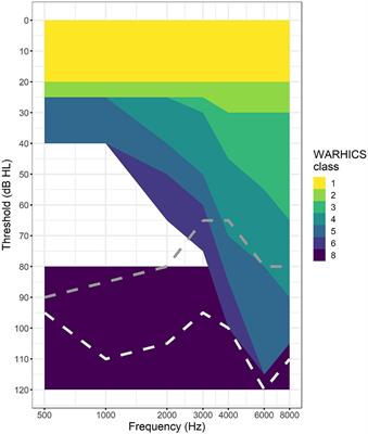 Using Machine Learning and the National Health and Nutrition Examination Survey to Classify Individuals With Hearing Loss